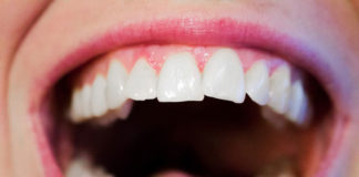 W jaki sposób prawidłowo dbać o zęby?